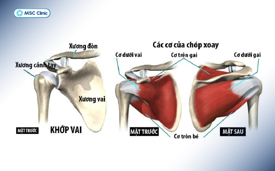 Nhóm cơ chóp xoay gồm 4 gân cơ chính giúp khớp vai vận động linh hoạt Nhóm cơ chóp xoay gồm 4 gân cơ chính giúp khớp vai vận động linh hoạt