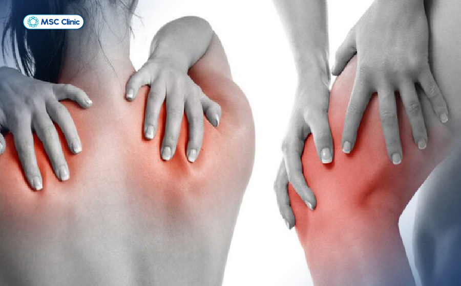 Phong thấp gây đau nhức, sưng viêm, ảnh hưởng đến toàn bộ hệ cơ xương khớp Phong thấp gây đau nhức, sưng viêm, ảnh hưởng đến toàn bộ hệ cơ xương khớp