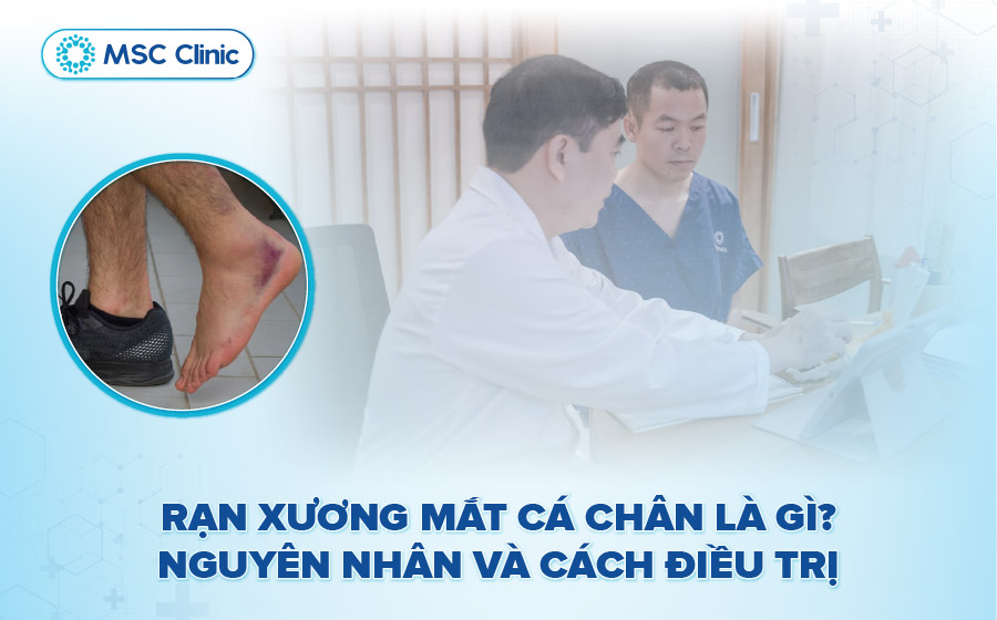 Rạn xương mắt cá chân là gì? Nguyên nhân và cách điều trị