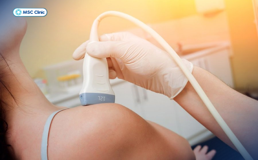 Siêu âm cơ xương khớp giúp phát hiện viêm gân, rách gân chóp xoay và các tổn thương mô mềm quanh vai Siêu âm cơ xương khớp giúp phát hiện viêm gân, rách gân chóp xoay và các tổn thương mô mềm quanh vai