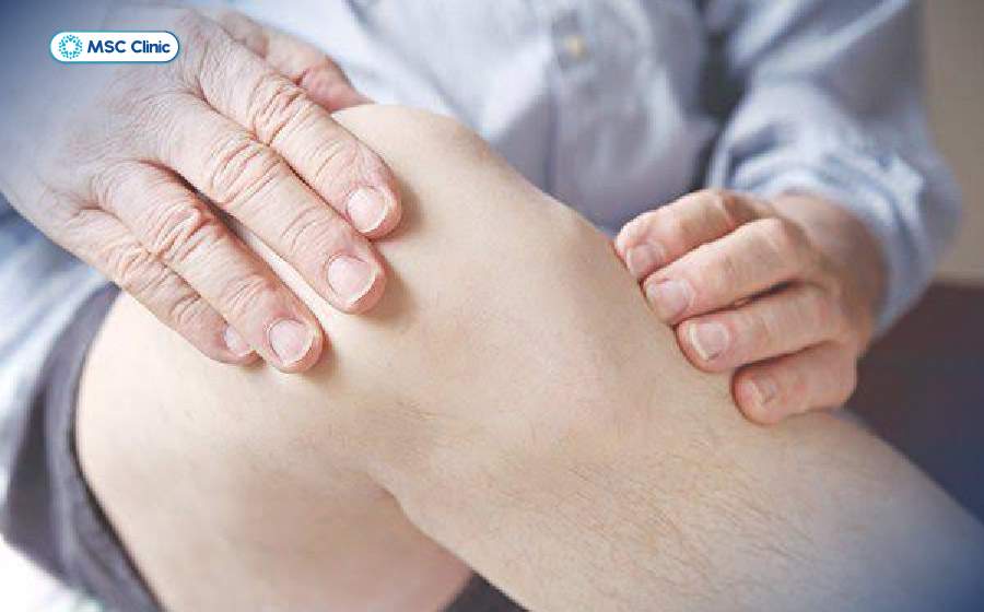 Thời gian hồi phục viêm dây chằng phụ thuộc vào vị trí tổn thương và mức độ viêm