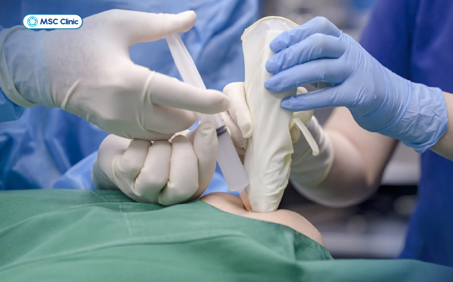 Tiêm PRP là phương pháp điều trị tái tạo hiệu quả cho trường hợp bả vai đau nhức không giơ lên cao được do viêm quanh khớp vai Tiêm PRP là phương pháp điều trị tái tạo hiệu quả cho trường hợp bả vai đau nhức không giơ lên cao được do viêm quanh khớp vai