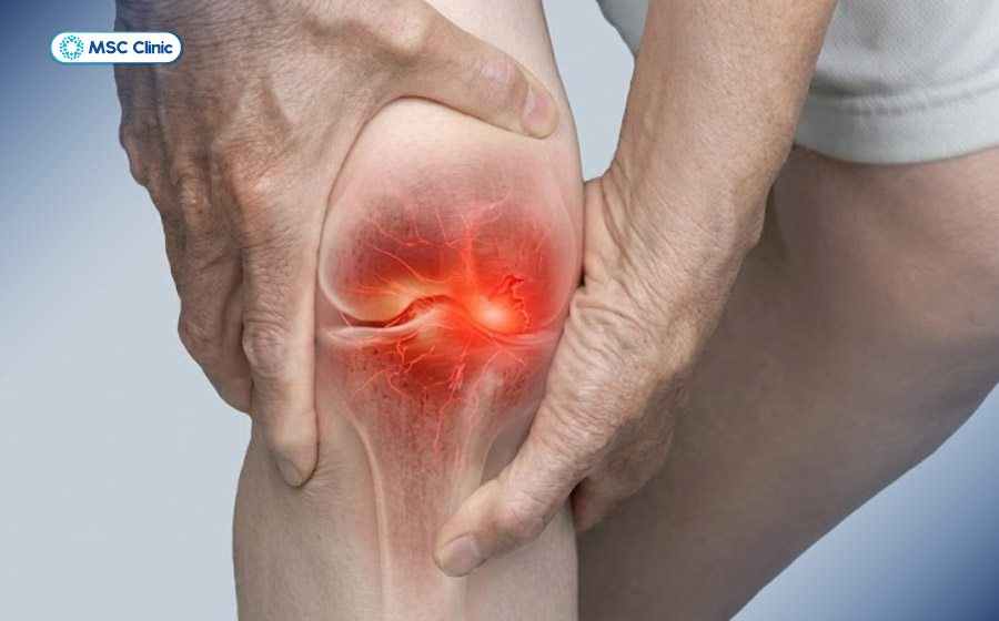 Viêm khớp dạng thấp là một trong những nguyên nhân gây đau đầu gối Viêm khớp dạng thấp là một trong những nguyên nhân gây đau đầu gối