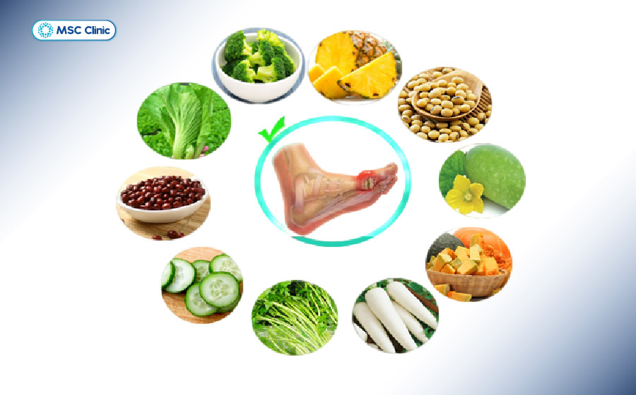 Chế độ dinh dưỡng là một trong những yếu tố quan trọng hỗ trợ kiểm soát bệnh gout hiệu quả Chế độ dinh dưỡng là một trong những yếu tố quan trọng hỗ trợ kiểm soát bệnh gout hiệu quả