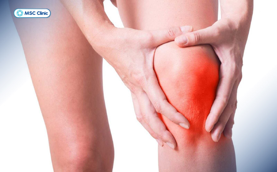 Đầu gối sưng đỏ sau khi ngã, chấn thương là dấu hiệu tổn thương dây chằng đầu gối