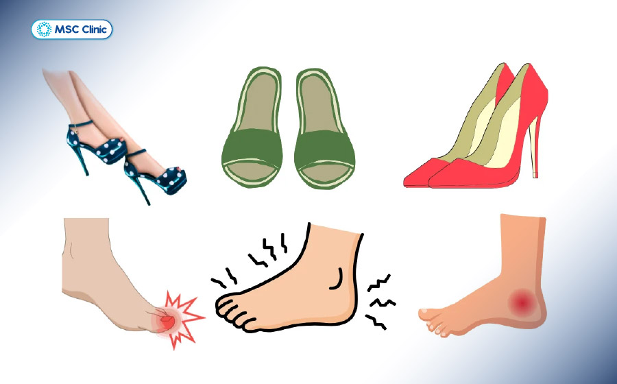 Đi lại nhiều với giày không phù hợp có thể làm áp lực phân bố không đều lên bàn chân