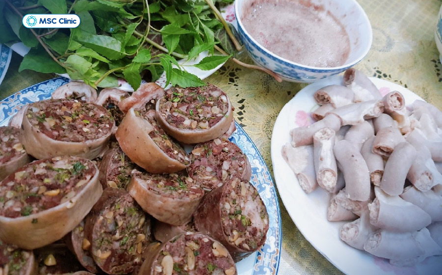 Người mắc gút cần hạn chế tiêu thụ nội tạng động vật để tránh làm tăng nồng độ acid uric Người mắc gút cần hạn chế tiêu thụ nội tạng động vật để tránh làm tăng nồng độ acid uric