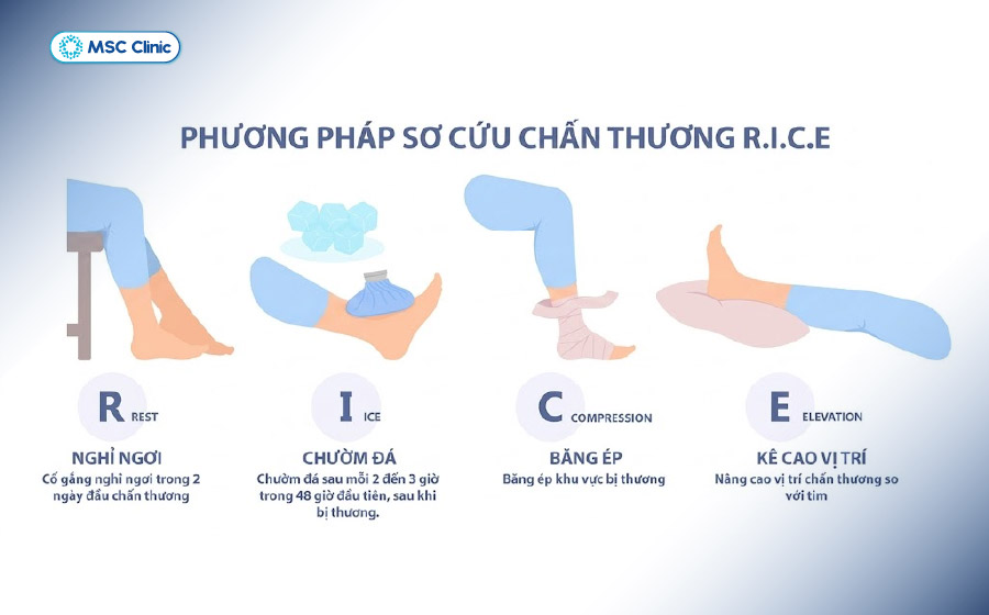 Nguyên tắc R.I.C.E thực hiện ngay khi có chấn thương dây chằng đầu gối