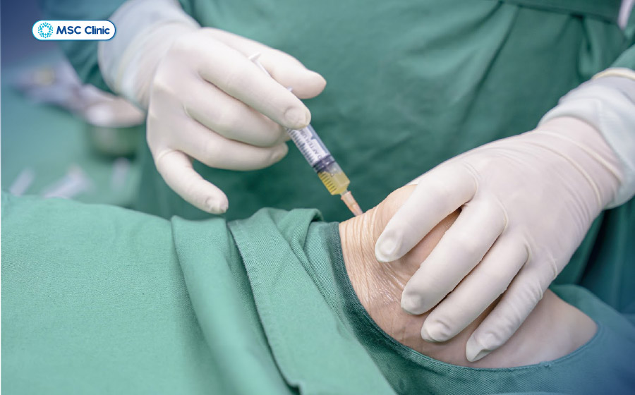 Thủ thuật tiêm PRP điều trị đau khớp bàn chân