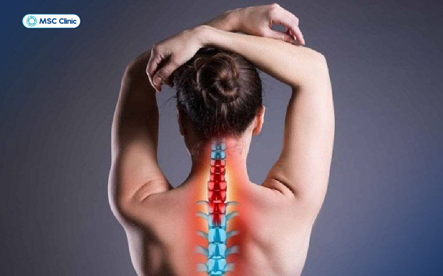 Bài tập thoát vị đĩa đệm cổ hỗ trợ giảm đau, phục hồi vận động và bảo tồn cột sống cổ Bài tập thoát vị đĩa đệm cổ hỗ trợ giảm đau, phục hồi vận động và bảo tồn cột sống cổ