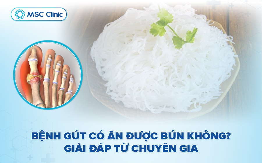 Bệnh gút có ăn được bún không? Giải đáp từ chuyên gia