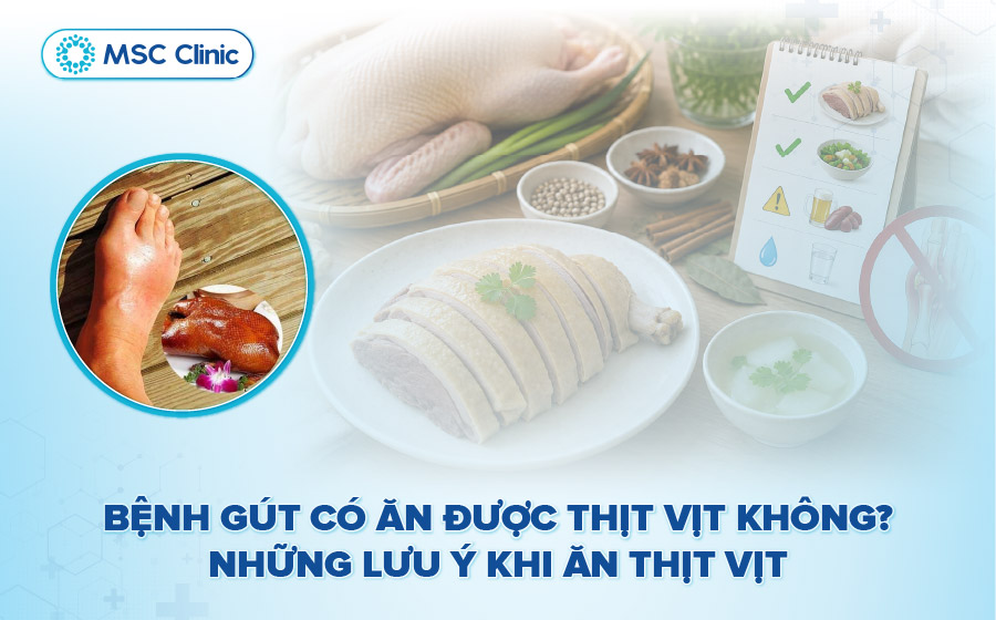 Bệnh gút có ăn được thịt vịt không? Những lưu ý khi ăn thịt vịt