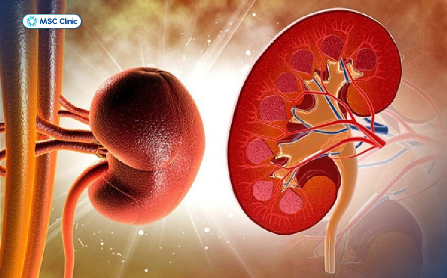 Bệnh thận mạn là một trong những nguyên nhân phổ biến dẫn đến loãng xương thứ phát Bệnh thận mạn là một trong những nguyên nhân phổ biến dẫn đến loãng xương thứ phát
