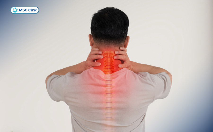 Bệnh thoái hóa cột sống cổ có thể gây đau âm ỉ và cứng cổ mạn tính