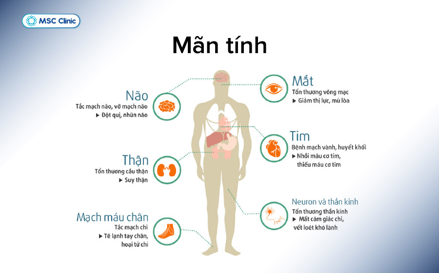 Bệnh tiểu đường có thể gây nhiều biến chứng mạn tính tại tim mạch, thận, mắt, thần kinh và bàn chân nếu không được kiểm soát tốt