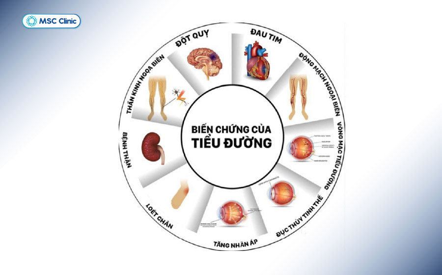 Biến chứng của đái tháo đường rất nghiêm trọng nếu không được kiểm soát kịp thời