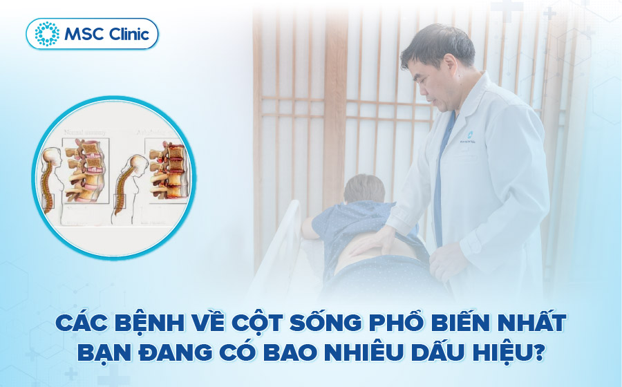 Các bệnh về cột sống thường gặp: Nguyên nhân và điều trị