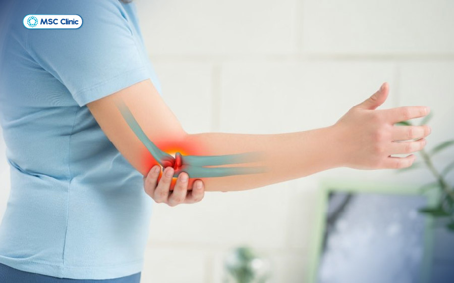 Các dấu hiệu thuyên giảm rõ rệt như đau, sưng là một tín hiệu tốt báo hiệu xương đang lành