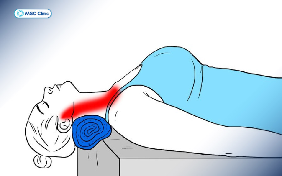 Các động tác kéo giãn cơ cổ giúp giảm áp lực lên cột sống cổ, góp phần phòng ngừa bệnh rễ thần kinh cổ