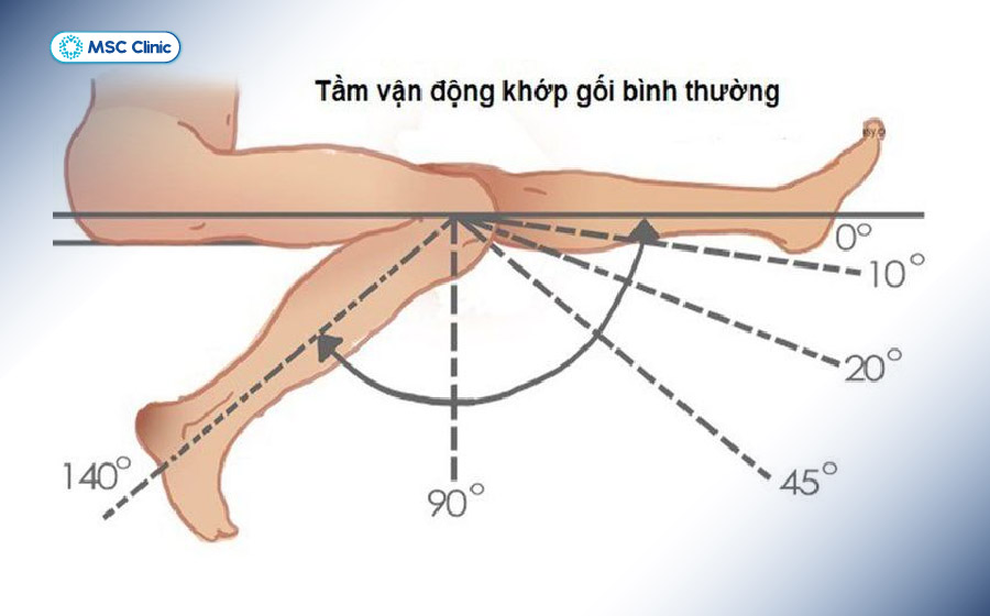 Cải thiện biên độ vận động là mục tiêu quan trọng hàng đầu khi vật lý trị liệu cho chân Cải thiện biên độ vận động là mục tiêu quan trọng hàng đầu khi vật lý trị liệu cho chân
