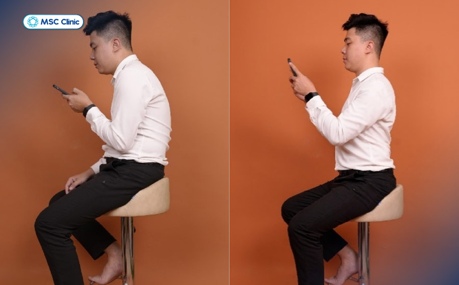 Cần điều chỉnh tư thế sinh hoạt, làm việc để hạn chế áp lực lên cột sống ngực