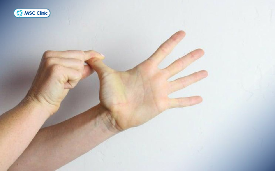 Chú ý lực kéo vừa phải, chỉ dừng ở mức căng nhẹ chứ không kéo đến mức gây đau nhói