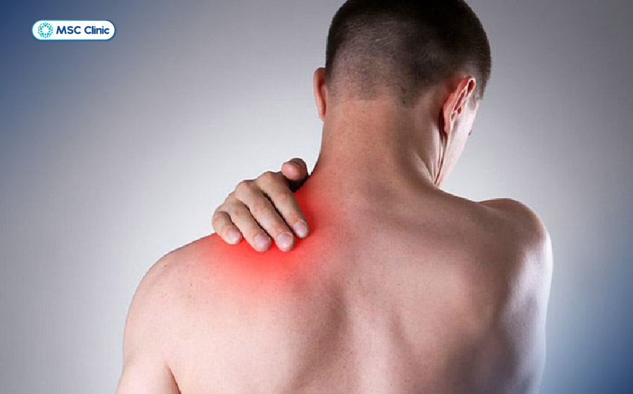 Đau cơ vai gây hạn chế vận động, làm suy giảm chất lượng cuộc sống Đau cơ vai gây hạn chế vận động, làm suy giảm chất lượng cuộc sống