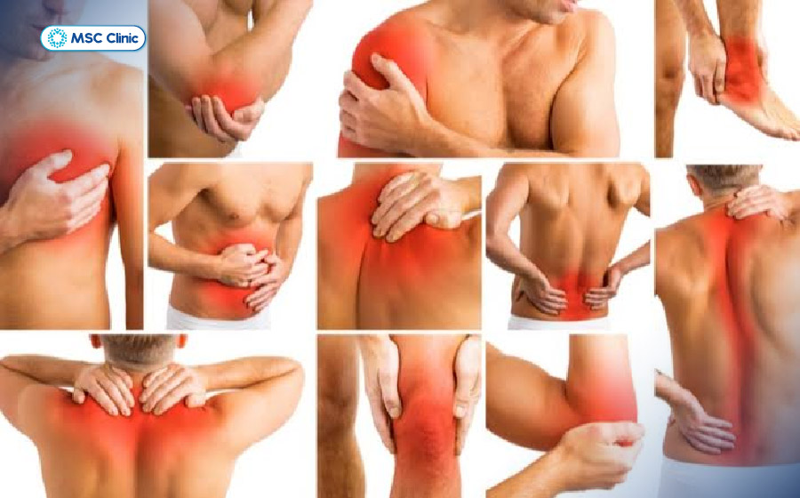 Đau cơ xơ hóa thường gây đau mạn tính tại nhiều vị trí như cổ, vai, lưng, hông và các chi Đau cơ xơ hóa thường gây đau mạn tính tại nhiều vị trí như cổ, vai, lưng, hông và các chi