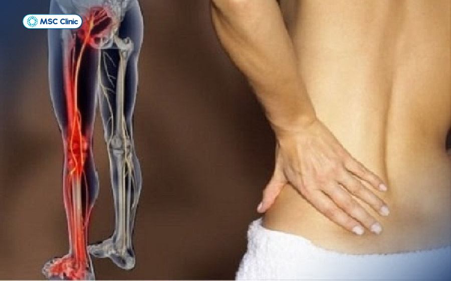 Đau lưng kéo dài, đau lan xuống chân, tê bì hoặc yếu chân là những dấu hiệu người bệnh nên thăm khám chuyên khoa