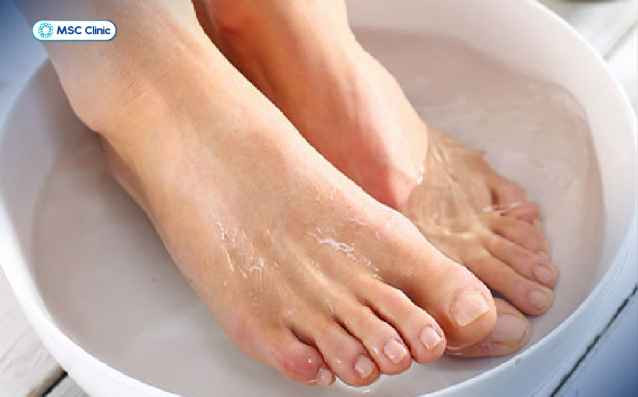 Đây là cách chữa đau gót chân dân gian tại nhà đơn giản, dễ thực hiện Đây là cách chữa đau gót chân dân gian tại nhà đơn giản, dễ thực hiện