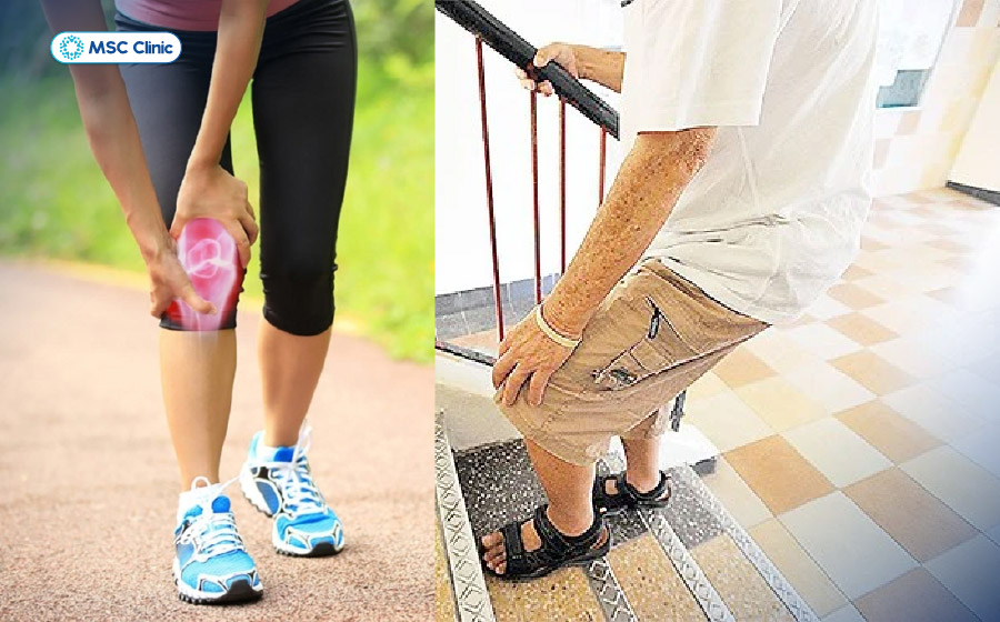 Đi bộ nhiều, leo cầu thang có thể làm quá tải các cấu trúc quanh khớp, khiến cảm giác nhức mỏi đầu gối về đêm rõ hơn 