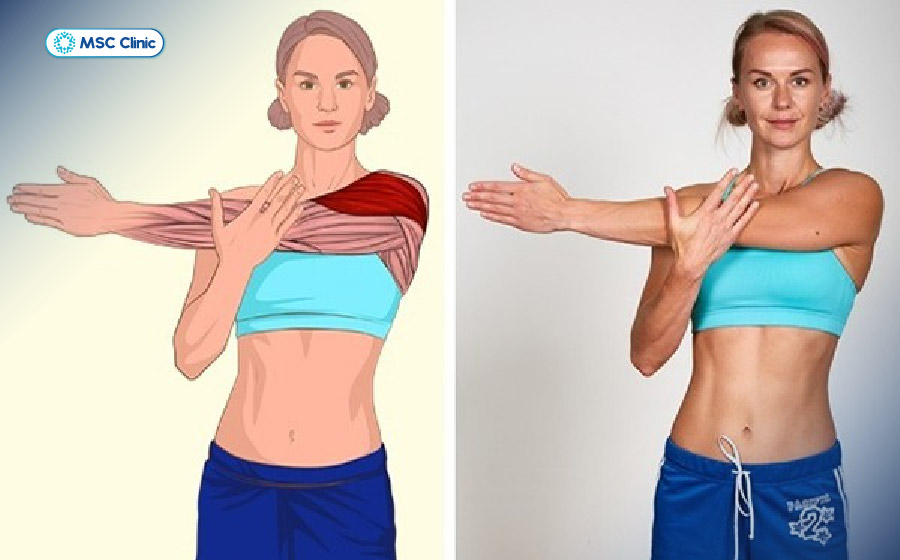 Động tác kéo giãn ngang vai có tác dụng giảm đau mỏi, tăng dẻo dai và giải tỏa căng cứng ở vùng cơ vai Động tác kéo giãn ngang vai có tác dụng giảm đau mỏi, tăng dẻo dai và giải tỏa căng cứng ở vùng cơ vai