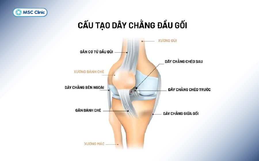 Hệ dây chằng chéo và dây chằng bên đóng vai trò quan trọng trong việc giữ vững khớp gối Hệ dây chằng chéo và dây chằng bên đóng vai trò quan trọng trong việc giữ vững khớp gối