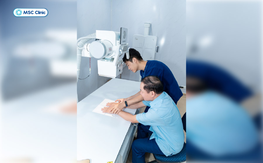 Hình ảnh X-quang hỗ trợ phát hiện các tổn thương xương và khớp ở giai đoạn tiến triển