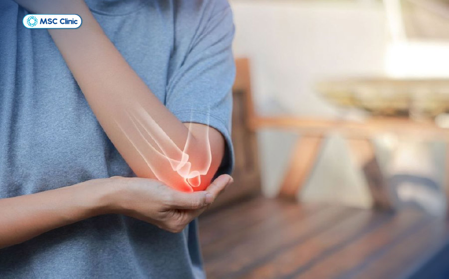 Khớp khuỷu tay cứng khiến người bệnh không thể tự sinh hoạt cá nhân cơ bản