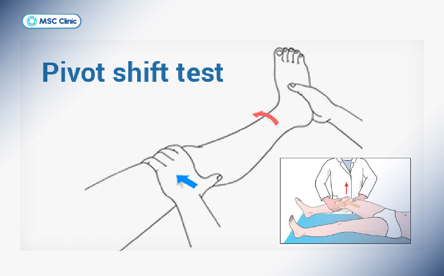 Nghiệm pháp chuyên biệt giúp bác sĩ xác định dây chằng nào bị tổn thương và mức độ mất vững của khớp Nghiệm pháp chuyên biệt giúp bác sĩ xác định dây chằng nào bị tổn thương và mức độ mất vững của khớp