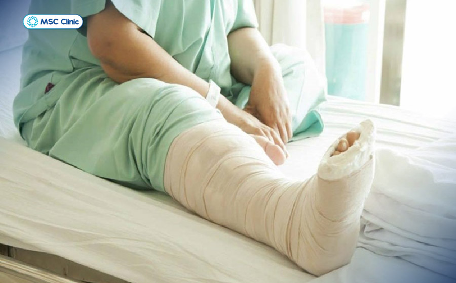 Người bệnh bị gãy xương do loãng xương phải nằm lâu có thể gặp thêm nhiều biến chứng khác Người bệnh bị gãy xương do loãng xương phải nằm lâu có thể gặp thêm nhiều biến chứng khác