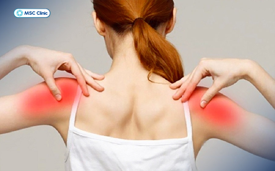Người bị trật khớp vai tái hồi có thể cảm thấy vai lỏng, sắp tuột hoặc trượt khỏi vị trí khi đưa tay sang ngang Người bị trật khớp vai tái hồi có thể cảm thấy vai lỏng, sắp tuột hoặc trượt khỏi vị trí khi đưa tay sang ngang