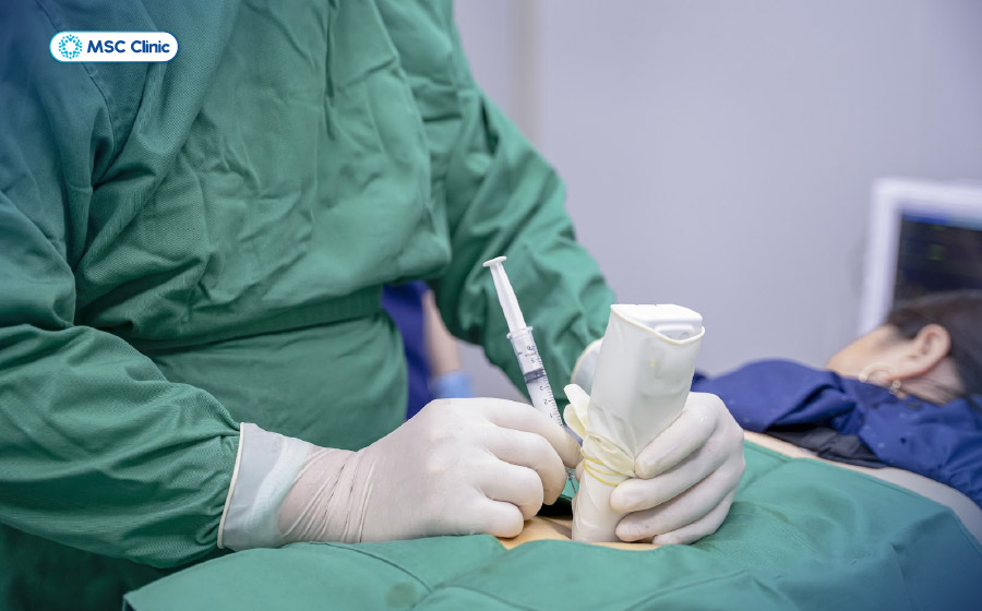 PRP sử dụng máu tự thân, tiêm trực tiếp vào vùng tổn thương và được cân nhắc trong một số bệnh lý cơ xương khớp