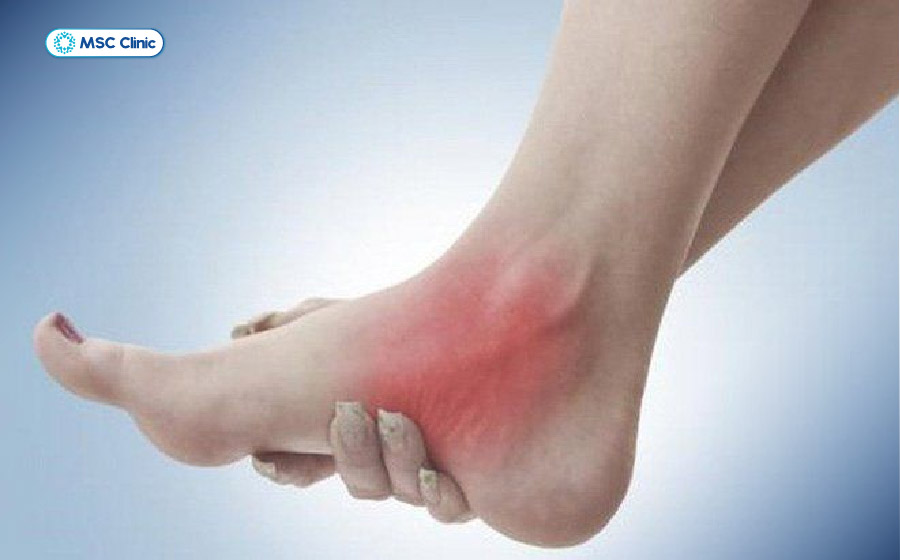 Sưng đau, hạn chế vận động là những dấu hiệu thường gặp sau bong gân hoặc chấn thương mô mềm quanh khớp