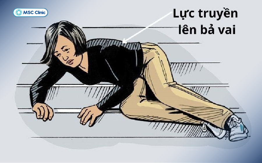 Tác động lực mạnh nguy cơ gây rách sụn viền khớp vai