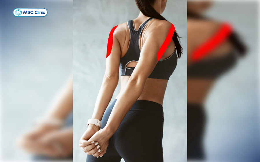 Tập bài tập ép hai bả vai đúng kỹ thuật giúp giảm nhanh đau mỏi và tăng cường các nhóm cơ bả vai Tập bài tập ép hai bả vai đúng kỹ thuật giúp giảm nhanh đau mỏi và tăng cường các nhóm cơ bả vai