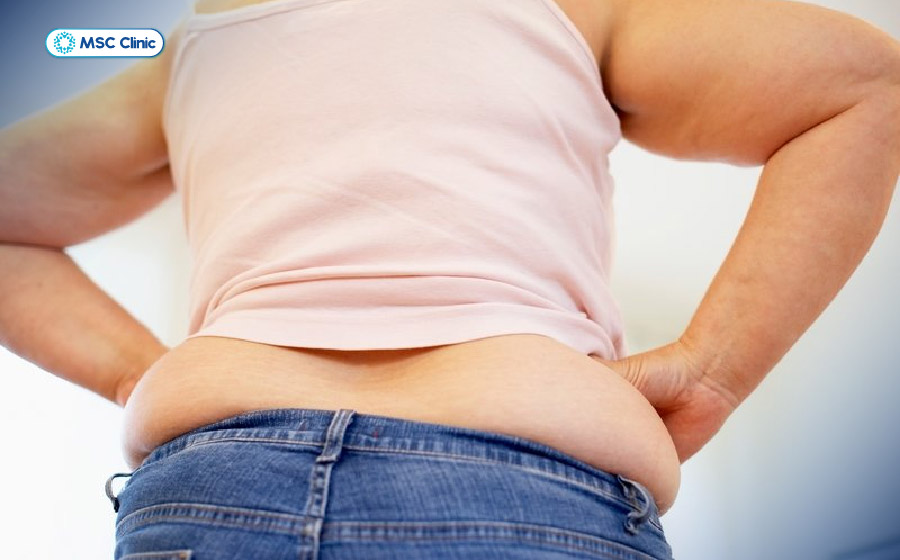 Thừa cân có thể làm tăng áp lực lên cột sống và là nguyên nhân gây đau lưng khi ngủ dậy