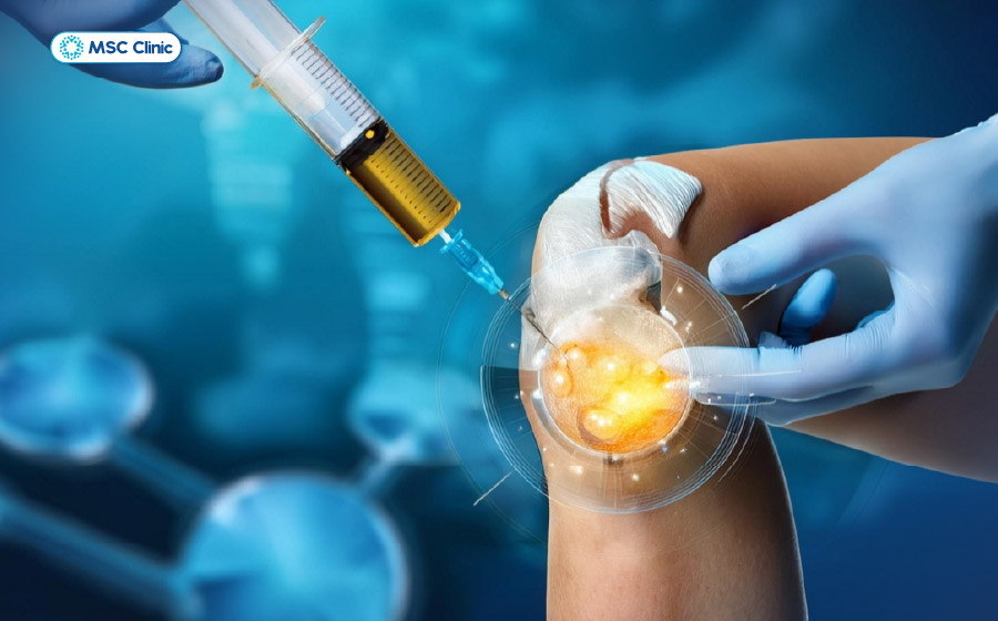 Tiêm huyết tương giàu tiểu cầu hỗ trợ đẩy nhanh quá trình làm lành tổn thương dây chằng