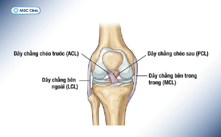 Tổn thương ACL, PCL hoặc dây chằng bên có thể làm đầu gối mất khả năng kiểm soát khi chịu lực và đổi hướng Tổn thương ACL, PCL hoặc dây chằng bên có thể làm đầu gối mất khả năng kiểm soát khi chịu lực và đổi hướng