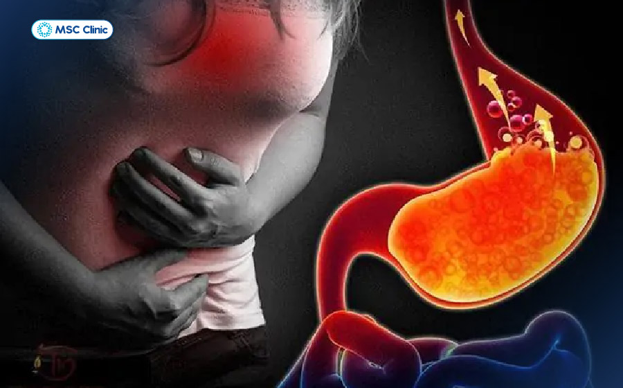 Trào ngược dạ dày cũng là một trong những nguyên nhân gây đau sau lưng vùng phổi