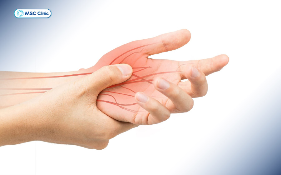 Triệu chứng tê bì tay khi thoát vị đĩa đệm cổ rất đáng lưu ý Triệu chứng tê bì tay khi thoát vị đĩa đệm cổ rất đáng lưu ý