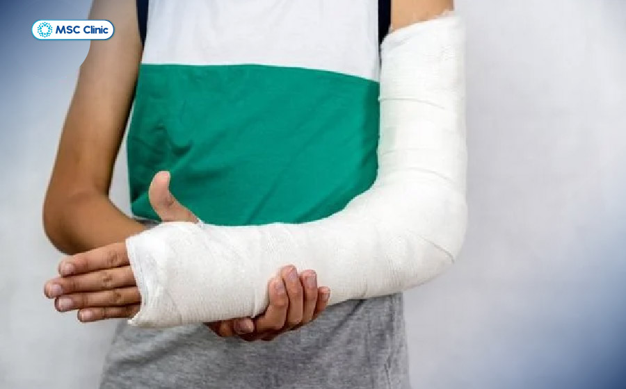 Tùy mức độ tổn thương, người bệnh có thể được điều trị bảo tồn bằng nẹp hoặc bó bột để cố định ổ gãy