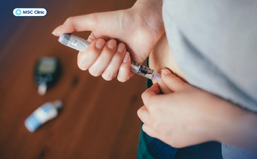 Vị trí tiêm insulin tốt nhất nằm ở vùng có lớp mô mỡ dưới da, trong đó có vùng bụng là nơi hấp thu nhanh nhất