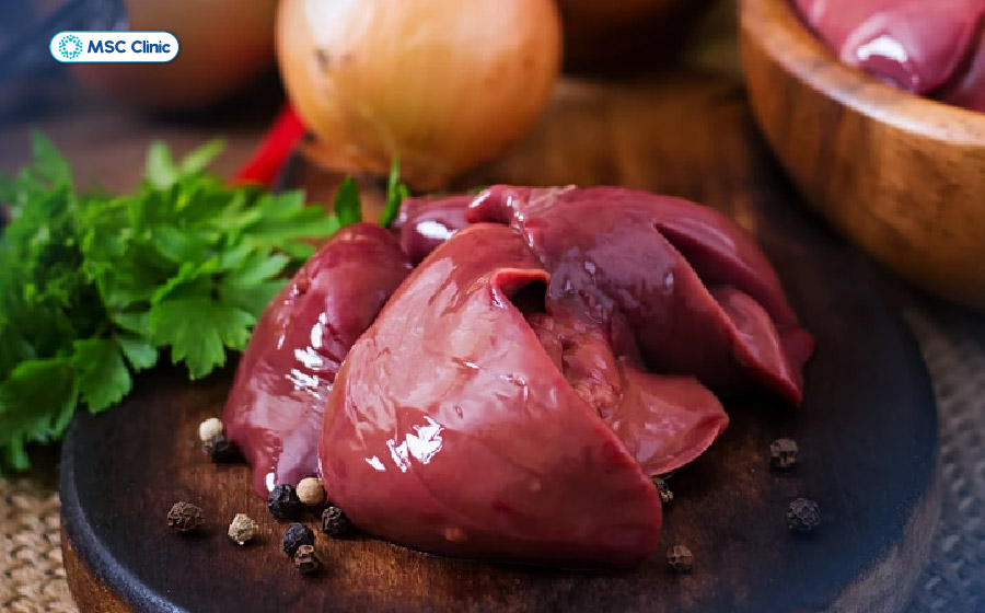 Với người bị gout, thực phẩm giàu purin cần được kiểm soát chặt chẽ